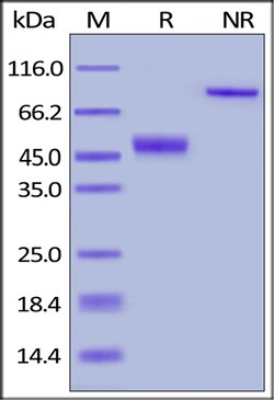 ACROBiosystems ACROBiosystems Human CTLA-4 / CD152 Protein, Fc Tag, Quantity: