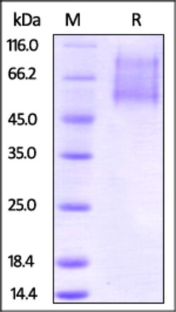 ACROBiosystems ACROBiosystems Biotinylated Human CX3CL1 Protein, His Tag,
