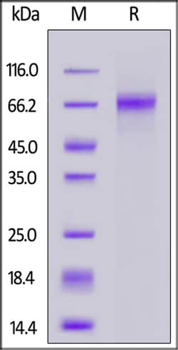 ACROBiosystems Cynomolgus DLL3 Protein, His Tag, Quantity: Each of 1