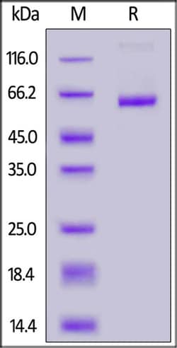 ACROBiosystems ACROBiosystems FITC-Labeled Human DLL3 Protein, Fc Tag,