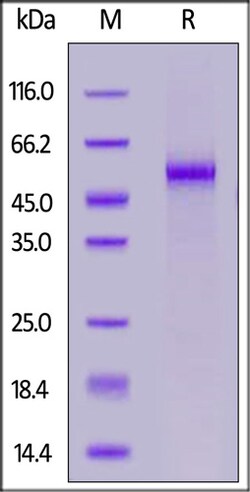 ACROBiosystems ACROBiosystems FITC-Labeled Human DLL3 Protein, His Tag,