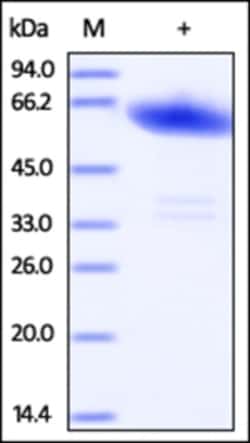 ACROBiosystems ACROBiosystems Human Ephrin-A3 / EFNA3 Protein, Fc Tag,