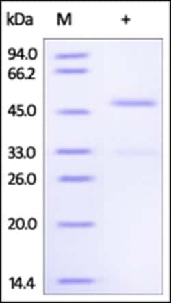 ACROBiosystems ACROBiosystems Human Ephrin-A4 / EFNA4 Protein, Fc Tag,