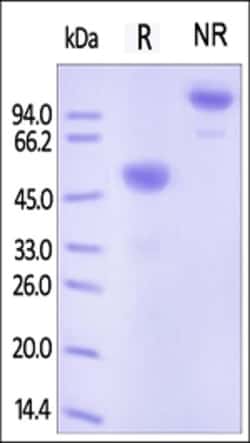 ACROBiosystems ACROBiosystems Human Ephrin-A1 / EFNA1 Protein, Fc Tag,
