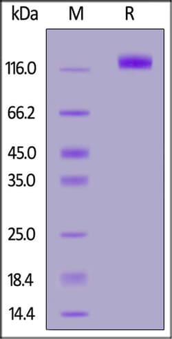 ACROBiosystems ACROBiosystems Human EGF R Protein, Llama IgG2b Fc Tag,