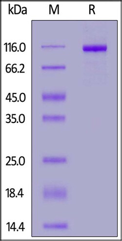 ACROBiosystems ACROBiosystems Mouse ENPP3 / CD203c Protein, His Tag (active