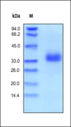 ACROBiosystems ACROBiosystems Human EpCAM / TROP1 Protein, His Tag, Quantity: