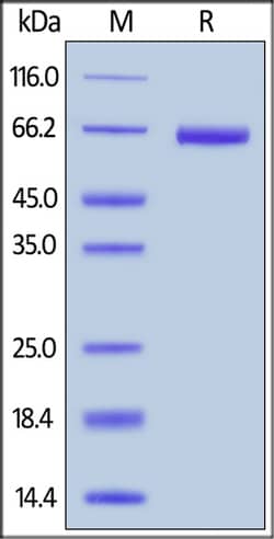 ACROBiosystems ACROBiosystems Biotinylated Human EpCAM / TROP1 Protein,