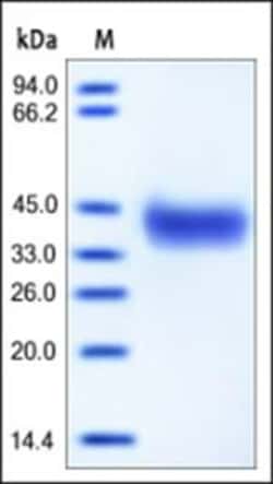 ACROBiosystems Mouse EpCAM / TROP1 Protein, His Tag, Quantity: Each of