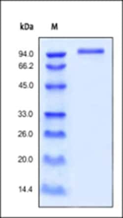 ACROBiosystems Recombinant Protein;Human ErbB3 / Her3 Protein, His Tag;HEK293;100UG;ER3,ERBB3,ErbB-3,HER3,HER-3,LCCS2,MDA-BF-1,MGC88033,c-erbB-3,c-erbB3,erbB3-S,p180-ErbB3,p45-sErbB3,p85-sErbB3,