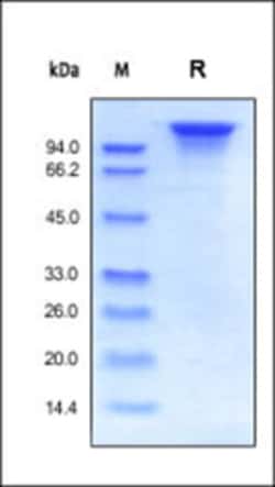 ACROBiosystems ACROBiosystems Human ErbB3 / Her3 Protein, Fc Tag, Quantity: