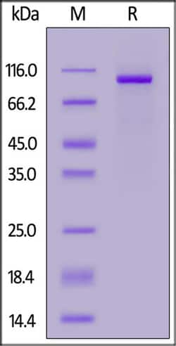 ACROBiosystems ACROBiosystems Mouse FAP Protein, His Tag (MALS verified),
