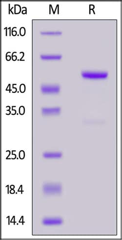 ACROBiosystems ACROBiosystems Human FGF19 Protein, Fc Tag, Quantity: Each