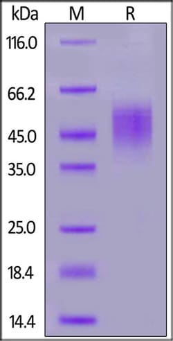 ACROBiosystems ACROBiosystems Mouse FGF R2 (IIIb) protein, His Tag, Quantity: