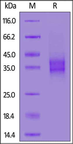 ACROBiosystems ACROBiosystems Biotinylated Mouse FOLR1 Protein, His,Avitag,