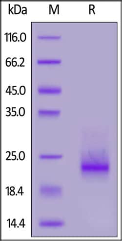 ACROBiosystems Human Frizzled-10 / FZD10 Protein, His Tag, Quantity: Each
