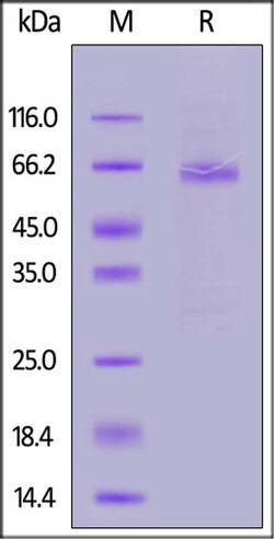 ACROBiosystems ACROBiosystems Hendra virus Fusion glycoprotein (A263T),