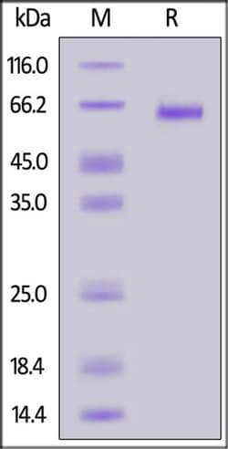 ACROBiosystems ACROBiosystems Nipah virus Fusion glycoprotein, His Tag,