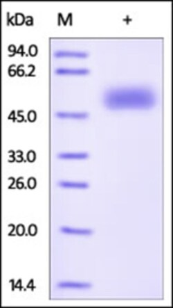 ACROBiosystems ACROBiosystems Human Frizzled-5 / FZD5 Protein, Fc Tag,