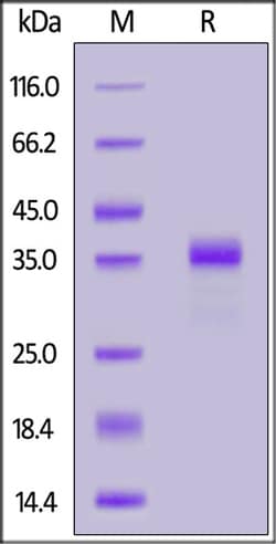 ACROBiosystems ACROBiosystems Biotinylated Human Gastrin-17 Protein, Fc,Avitag