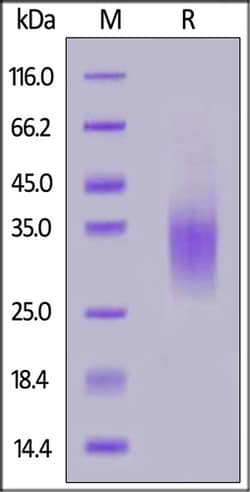 ACROBiosystems ACROBiosystems Human GCGR / Glucagon receptor Protein, His