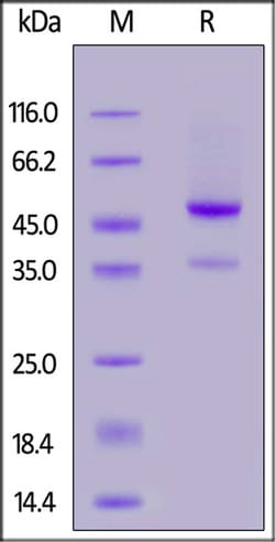 ACROBiosystems ACROBiosystems Human latent GDF-8 Protein, His Tag (MALS