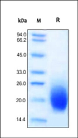 ACROBiosystems Recombinant Protein;ActiveMax Recombinant Human GM-CSF;HEK293;20UG;GMF,GM-CSF,GMCSF,CSF2,CSF-2,MGC131935,MGC138897,