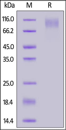 ACROBiosystems ACROBiosystems Epstein-Barr virus (Herpesvirus 4) EBV Glycoprotein