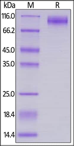 ACROBiosystems ACROBiosystems Biotinylated HIV-1 [HIV-1/Clade B/C (CN54)]