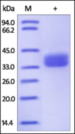 ACROBiosystems ACROBiosystems Human GPA33 / A33 Protein, His Tag, Quantity: