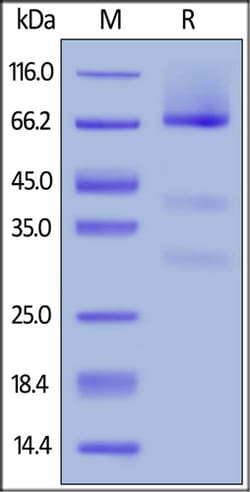ACROBiosystems ACROBiosystems Human Glypican 3 / GPC3 Protein, His Tag