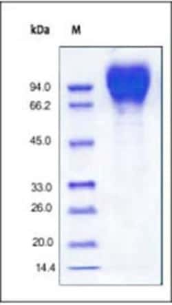 ACROBiosystems Recombinant Protein;Recombinant HIV-1 [HIV-1/Clade B/C (CN54)]