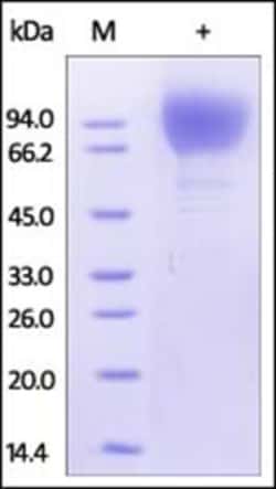 ACROBiosystems Recombinant Protein;Recombinant HIV-1 [HIV-1/Clade C (16055)]