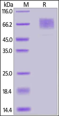 ACROBiosystems Mouse GUCY2C / Guanylyl cyclase C Protein, His Tag, Quantity: