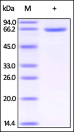 ACROBiosystems Recombinant Protein;Human HSA Protein;HEK293;500UG;HSA,HSA,ALB,Serum