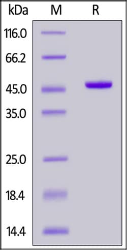ACROBiosystems ACROBiosystems Human IDH1 Protein, His Tag (active enzyme,