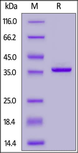 ACROBiosystems&nbsp;Streptococcus pyogenes IdeS Protein, His Tag