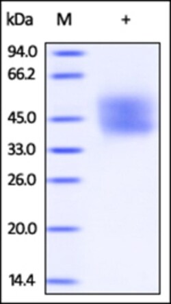 ACROBiosystems ACROBiosystems Human IFN-alpha/beta R2 Protein, His Tag,