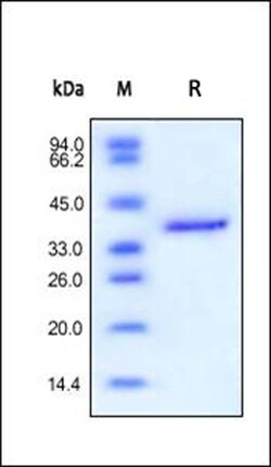 ACROBiosystems ACROBiosystems Human IGF-II Protein, Fc Tag, Quantity: Each