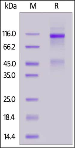 ACROBiosystems ACROBiosystems Human IGF-I R / CD221 Protein, His Tag, Quantity: