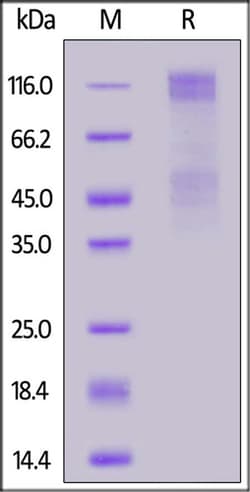 ACROBiosystems ACROBiosystems Biotinylated Human IGF-I R / CD221 Protein,