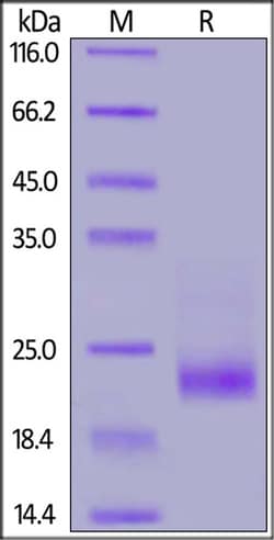 ACROBiosystems Cynomolgus IL-31 Protein, His Tag, Quantity: Each of 1