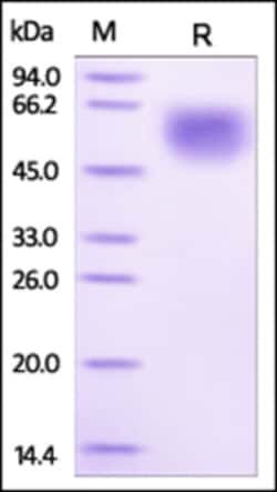 ACROBiosystems ACROBiosystems Human IL-1RL1 / ST2 Protein, His Tag, Quantity: