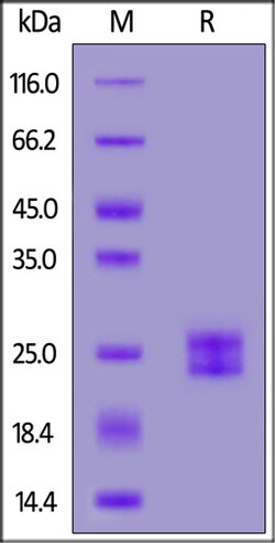ACROBiosystems Human IL-11 Protein, His Tag, Quantity: Each of 1
