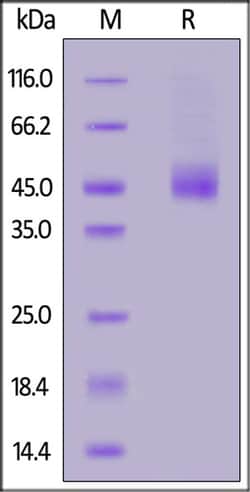 ACROBiosystems ACROBiosystems Canine IL-13 R alpha 2 Protein, His Tag,