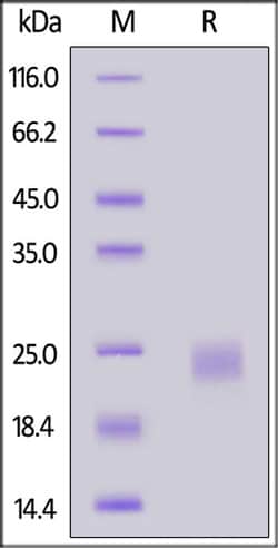 ACROBiosystems ACROBiosystems Mouse IL-2 Protein, His Tag, Quantity: Each