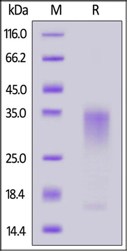 ACROBiosystems ACROBiosystems Canine IL-13 Protein, His Tag, Quantity: