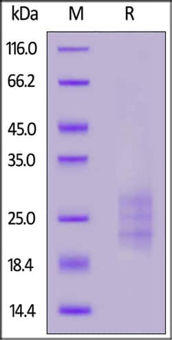 ACROBiosystems Mouse IL-33 Protein, His Tag, Quantity: Each of 1