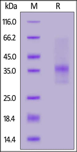 ACROBiosystems Human IL-34 Protein, His Tag, Quantity: Each of 1