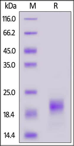 ACROBiosystems ACROBiosystems Cynomolgus IL-5 Protein, His Tag, Quantity: